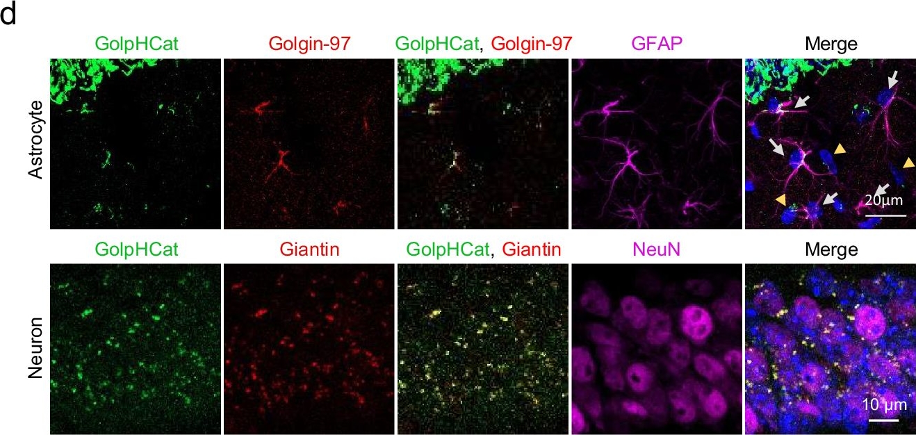 Fig.6.D showing Immunocytochemistry-immunofluorescence in a Homo sapiens (Human) sample from the publication: GolpHCat (TMEM87A), a unique voltage-dependent cation channel in Golgi apparatus, contributes to Golgi-pH maintenance and hippocampus-dependent memory.