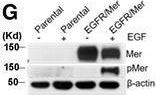 Fig.1.G showing Western Blotting from the publication: Normalization of TAM post-receptor signaling reveals a cell invasive signature for Axl tyrosine kinase.