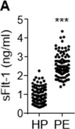 Fig.1.A showing Enzyme-linked immunosorbent assay from the publication: Circulating miRNAs Associated with Dysregulated Vascular and Trophoblast Function as Target-Based Diagnostic Biomarkers for Preeclampsia.