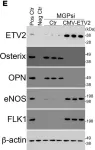 Fig.5.E showing Western Blotting in a Mus musculus (House mouse) sample from the publication: CDK1 inhibition reduces osteogenesis in endothelial cells in vascular calcification.