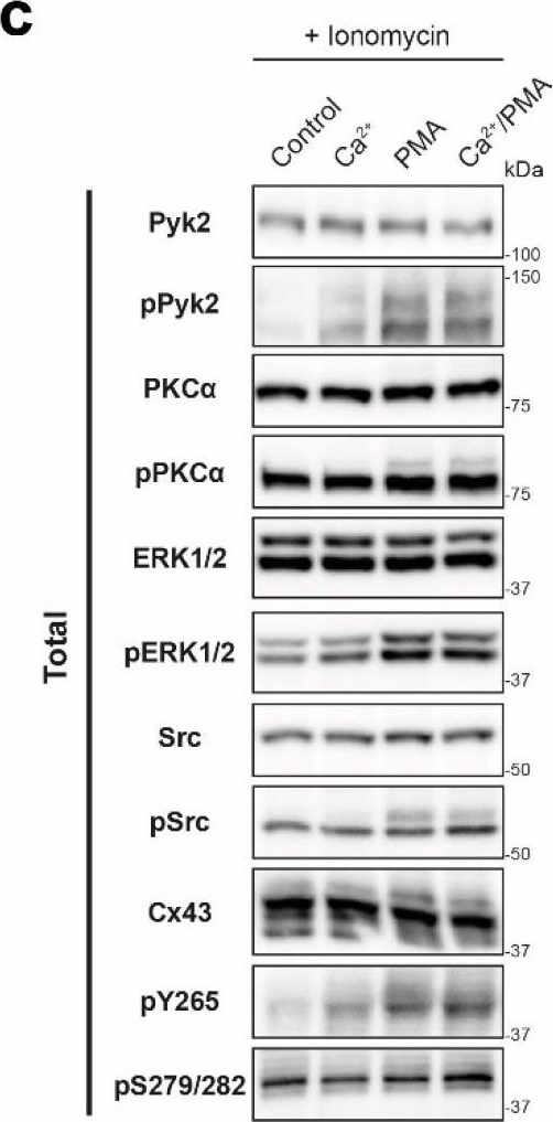 Fig.9.C showing Western Blotting in a Homo sapiens (Human) sample from the publication: Calmodulin Directly Interacts with the Cx43 Carboxyl-Terminus and Cytoplasmic Loop Containing Three ODDD-Linked Mutants (M147T, R148Q, and T154A) that Retain α-Helical Structure, but Exhibit Loss-of-Function and Cellular Trafficking Defects.