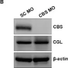 Fig.3.B showing Western Blotting from the publication: Moderate Elevation of Homocysteine Induces Endothelial Dysfunction through Adaptive UPR Activation and Metabolic Rewiring.