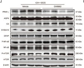 Fig.6.J showing Western Blotting from the publication: HD-tDCS Restores Perivascular AQP4 Polarization via PPARγ Modulation to Enhance Glymphatic Clearance After Intracerebral Hemorrhage in Mice.