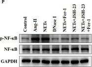 Fig.4.P showing Western Blotting from the publication: NETs drive myocardial fibrosis in hypertension via an NF-κB/ferroptosis axis.