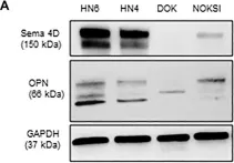 Fig.5.A showing Western Blotting from the publication: Cytokine profiling in plasma distinguishes the histological inflammatory subtype of head and neck squamous cell carcinoma and a novel regulatory role of osteopontin.