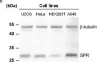 Fig.3.C showing Western Blotting from the publication: Semisynthetic biosensors for mapping cellular concentrations of nicotinamide adenine dinucleotides.