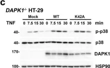 Fig.6.C showing Western Blotting from the publication: Tumor suppressor death-associated protein kinase 1 inhibits necroptosis by p38 MAPK activation.