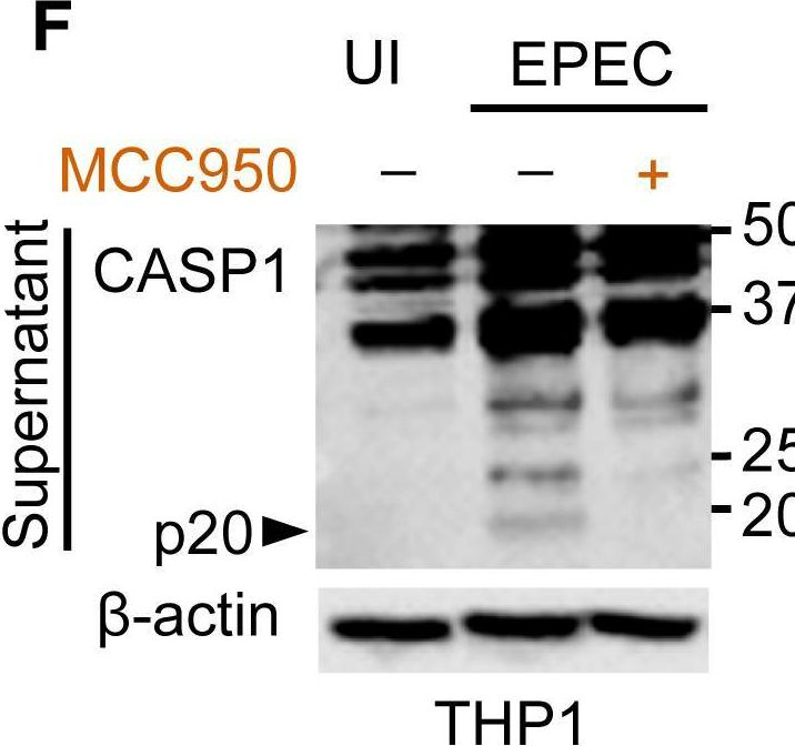 Fig.1.F showing Western Blotting in a Homo sapiens (Human) sample from the publication: Enteropathogenic Escherichia coli Stimulates Effector-Driven Rapid Caspase-4 Activation in Human Macrophages.