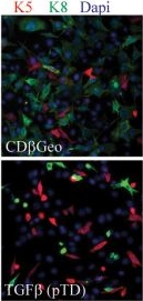 Oncogenic transformation of mammary epithelial cells by transforming growth factor beta independent of mammary stem cell regulation.
