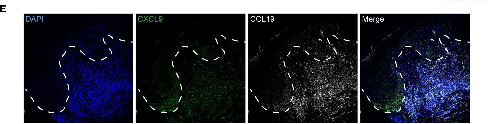 Fig.2.E showing Immunohistochemistry-immunofluorescence in a Homo sapiens (Human) sample from the publication: CXCL9, CXCL10, and CCL19 synergistically recruit T lymphocytes to skin in lichen planus.