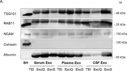 Fig.7.A showing Western Blotting from the publication: Exosome isolation from distinct biofluids using precipitation and column-based approaches.