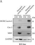 Fig.5.A showing Western Blotting from the publication: MURC/cavin-4 Is Co-Expressed with Caveolin-3 in Rhabdomyosarcoma Tumors and Its Silencing Prevents Myogenic Differentiation in the Human Embryonal RD Cell Line.