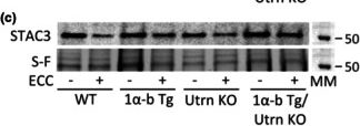 Fig.6.C showing Western Blotting in a Mus musculus (House mouse) sample from the publication: Skeletal muscle-specific PGC-1α-b overexpression prevents eccentric contraction-induced muscle injury through an utrophin-independent pathway in mice.