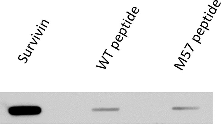 Fig.5.A showing Western Blotting in a Homo sapiens (Human) sample from the publication: Circulating CD9+/GFAP+/survivin+ exosomes in malignant glioma patients following survivin vaccination.