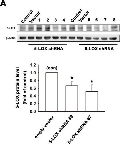 Fig.4.A showing Western Blotting in a Homo sapiens (Human) sample from the publication: 5-Lipoxygenase inhibitors attenuate TNF-α-induced inflammation in human synovial fibroblasts.