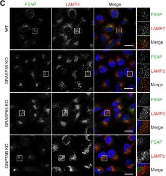 Fig.2.C showing Immunocytochemistry-immunofluorescence from the publication: GRASP55 maintains lysosome function by controlling sorting of lysosomal enzymes at the Golgi.