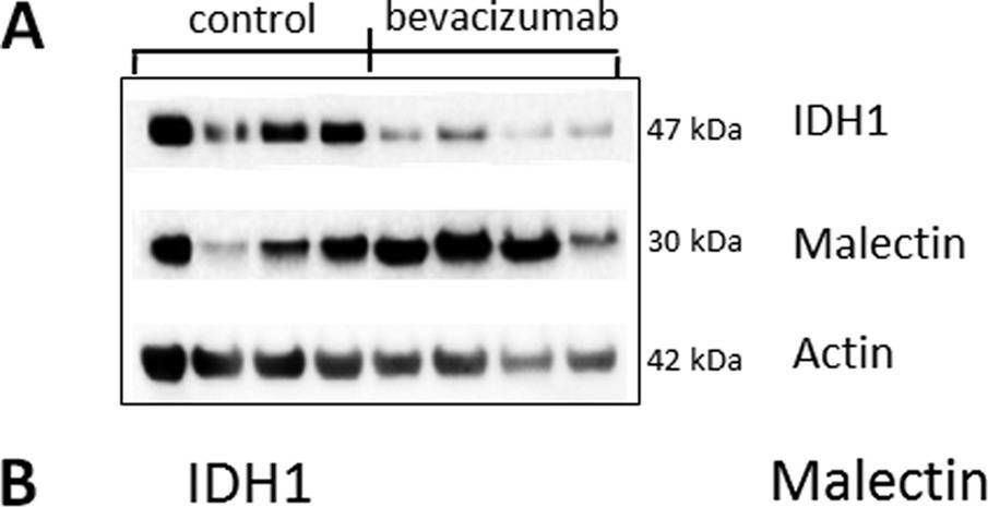 Fig.5.A showing Western Blotting from the publication: Targeted Proteomics to Assess the Response to Anti-Angiogenic Treatment in Human Glioblastoma (GBM).