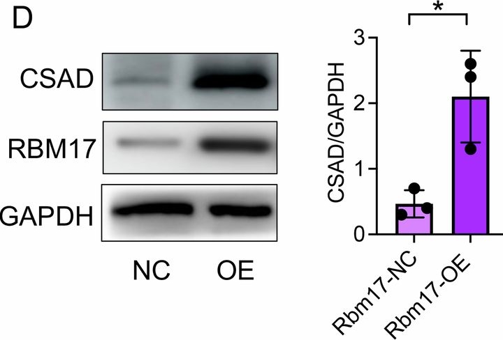Fig.5.D showing Western Blotting from the publication: RBM17 promotes hepatocellular carcinoma progression by regulating lipid metabolism and immune microenvironment: implications for therapeutic targeting.