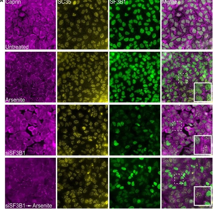 Fig.3.A showing Immunocytochemistry-immunofluorescence in a Homo sapiens (Human) sample from the publication: Nuclear RNA-related processes modulate the assembly of cytoplasmic RNA granules.