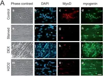 Fig.3.A showing Immunocytochemistry-immunofluorescence from the publication: Inhibition of atrogin-1/MAFbx mediated MyoD proteolysis prevents skeletal muscle atrophy in vivo.
