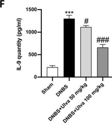 Fig.3.F showing Enzyme-linked immunosorbent assay from the publication: Ulva pertusa, a Marine Green Alga, Attenuates DNBS-Induced Colitis Damage via NF-κB/Nrf2/SIRT1 Signaling Pathways.