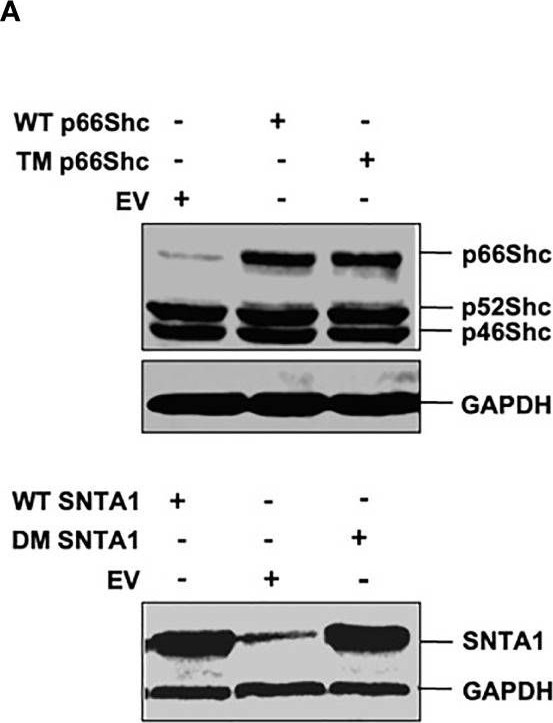 Fig.3.A showing Western Blotting in a Homo sapiens (Human) sample from the publication: Actin Modulation Regulates the Alpha-1-Syntrophin/p66Shc Mediated Redox Signaling Contributing to the RhoA GTPase Protein Activation in Breast Cancer Cells.