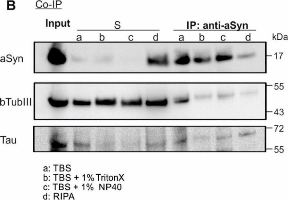 Fig.1.B showing Western Blotting in a Homo sapiens (Human) sample from the publication: Interaction of Alpha Synuclein and Microtubule Organization Is Linked to Impaired Neuritic Integrity in Parkinson's Patient-Derived Neuronal Cells.