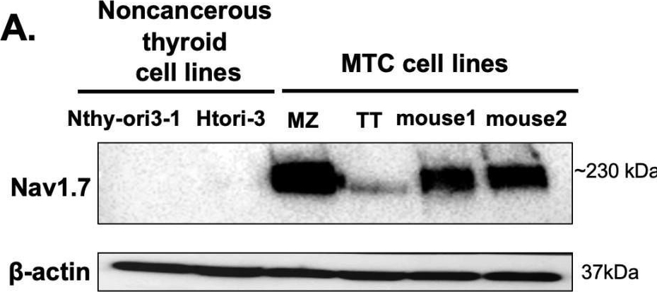 Fig.3.A showing Western Blotting in a Homo sapiens (Human) sample from the publication: Voltage-Gated Sodium Channel NaV1.7 Inhibitors with Potent Anticancer Activities in Medullary Thyroid Cancer Cells.