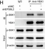 Fig.5.H showing Western Blotting from the publication: EPS8L2 drives colorectal cancer cell proliferation and migration via YBX1-dependent activation of G3BP2 transcription.