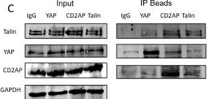 Fig.3.C showing Western Blotting from the publication: The Regulation of the Hippo Signalling Pathway Effector YAP Through a Novel Lipid-Dependent Extracellular Matrix Complex.