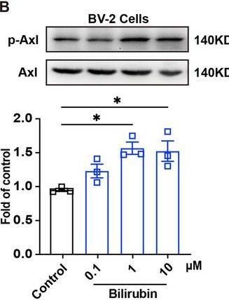 Fig.3.B showing Western Blotting from the publication: Bilirubin Alleviates Spinal Cord Injury by Enhancing SOCS3-Mediated Anti-Inflammatory Effects via Gas6-Axl Signaling.