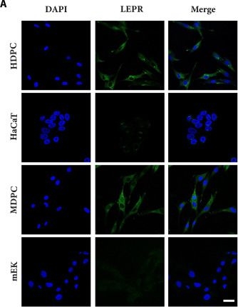 Fig.2.A showing Immunocytochemistry-immunofluorescence from the publication: Oxidative Stress and Hormone-Regulated Dermal Papilla Cell-Targeted Nanomodulators: Reverse Cellular Senescence for Androgenetic Alopecia Therapy.
