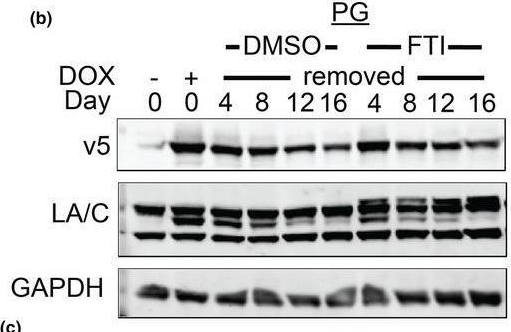 Fig.4.B showing Western Blotting in a Homo sapiens (Human) sample from the publication: Genetic and pharmacological modulation of lamin A farnesylation determines its function and turnover.