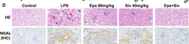 Fig.3.D showing Immunohistochemistry from the publication: A Novel IDO1/NE Dual Inhibitor, IMM-H018 Prevents the Primary and Secondary Sepsis and Ameliorates the Kidney Injury Through Inhibiting the Cytokine Storm and Microthrombosis, and Reversing Immunosuppression.