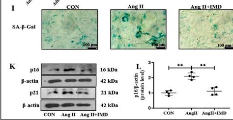 Fig.2.I showing Western Blotting in a Mus musculus (House mouse) sample from the publication: Intermedin Inhibits DNA Damage-Promoted Senescent Phenotype Transition of Vascular Smooth Muscle Cells in Aorta by Activating NAMPT/PARP1 in Mice.