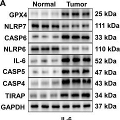 Fig.10.A showing Western Blotting from the publication: Comprehensive characterization of pyroptosis phenotypes with distinct tumor immune profiles in gastric cancer to aid immunotherapy.
