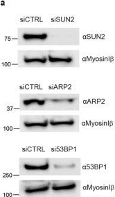 Fig.8.A showing Western Blotting in an Armoracia rusticana (Horseradish) sample from the publication: Chromatin compartmentalization regulates the response to DNA damage.