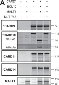 Fig.1.A showing Western Blotting from the publication: CARD10 cleavage by MALT1 restricts lung carcinoma growth in vivo.