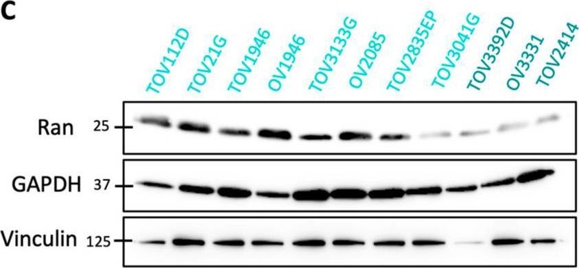 Fig.1.C showing Western Blotting in a Homo sapiens (Human) sample from the publication: The Small GTPase Ran Increases Sensitivity of Ovarian Cancer Cells to Oncolytic Vesicular Stomatitis Virus.