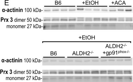 Fig.4.E showing Western Blotting in a Mus musculus (House mouse) sample from the publication: NOX2 amplifies acetaldehyde-mediated cardiomyocyte mitochondrial dysfunction in alcoholic cardiomyopathy.
