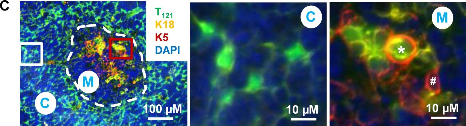 RB inactivation in keratin 18 positive thymic epithelial cells promotes non-cell autonomous T cell hyperproliferation in genetically engineered mice.