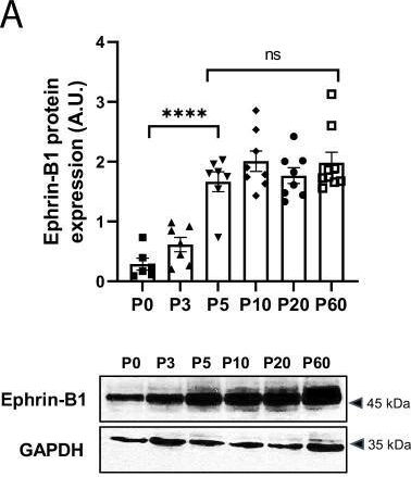 Fig.5.A showing Western Blotting from the publication: Ephrin-B1 regulates the adult diastolic function through a late postnatal maturation of cardiomyocyte surface crests.