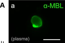 Fig.6.A showing Immunocytochemistry-immunofluorescence in a Homo sapiens (Human) sample from the publication: Wasteosomes (corpora amylacea) of human brain can be phagocytosed and digested by macrophages.