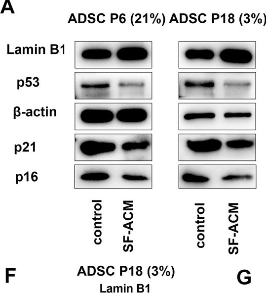 Fig.4.A showing Western Blotting from the publication: A serum-free adipose-conditioned medium delays stem cell senescence and maintains tissue homeostasis via IL-6/STAT3 axis suppression.
