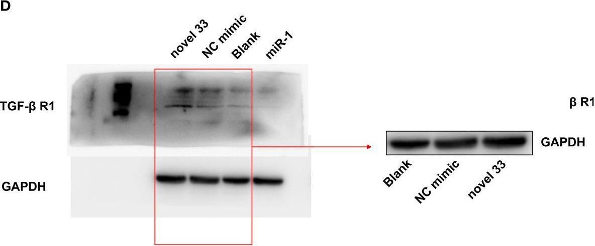 Fig.5.D showing Western Blotting from the publication: A Novel miRNA From Egg-Derived Exosomes of Schistosoma japonicum Promotes Liver Fibrosis in Murine Schistosomiasis.