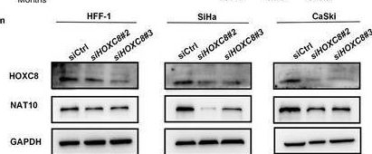 Fig.2.N showing Western Blotting in a Homo sapiens (Human) sample from the publication: NAT10/ac4C/FOXP1 Promotes Malignant Progression and Facilitates Immunosuppression by Reprogramming Glycolytic Metabolism in Cervical Cancer.