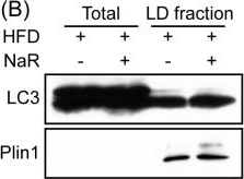 Fig.5.B showing Western Blotting from the publication: Sodium Rutin Ameliorates Non-Alcoholic Fatty Liver Disease and Alleviates Insulin Resistance by Promoting Lipophagy.