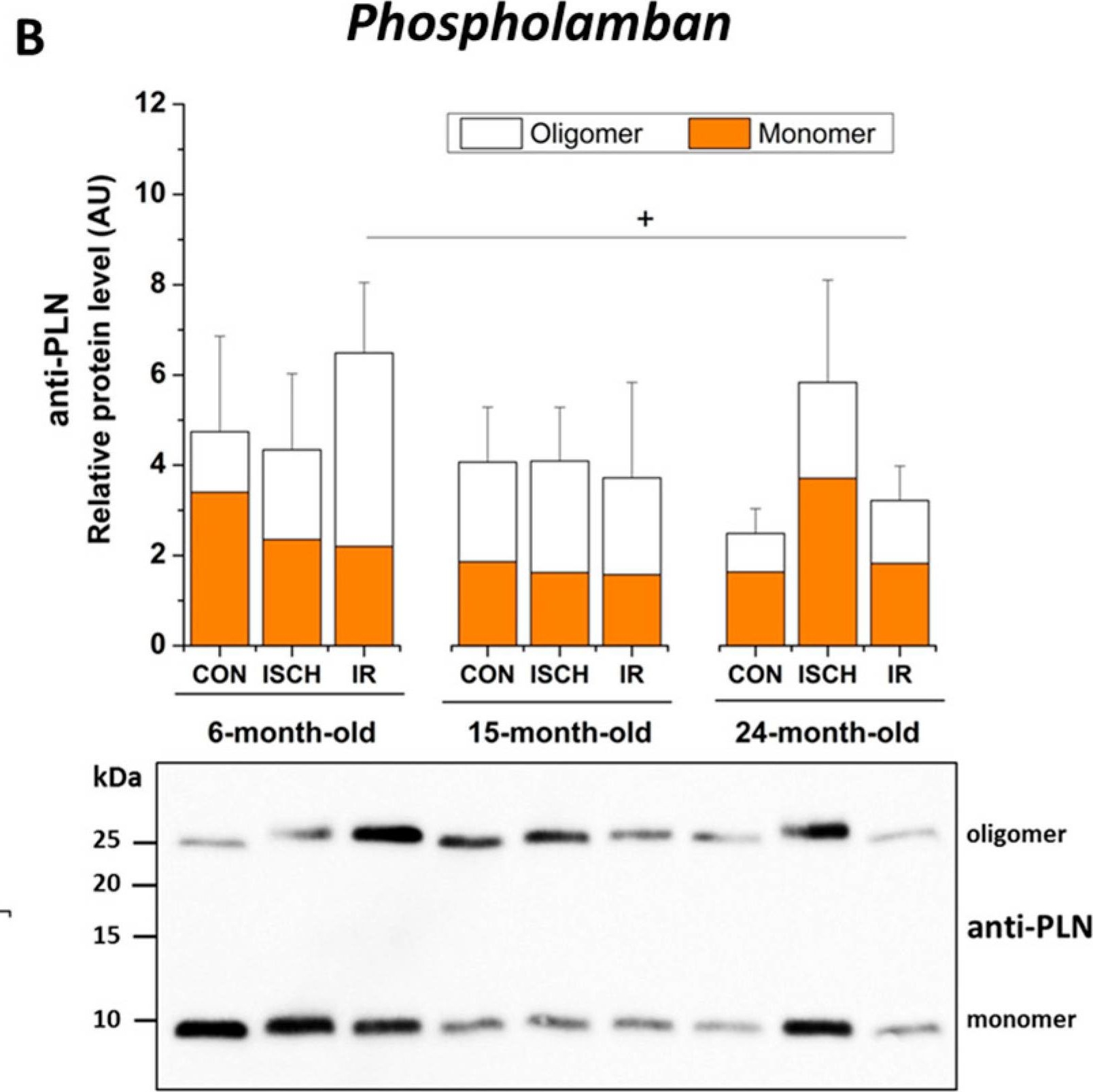 Fig.5.B showing Western Blotting from the publication: Age-Dependent Changes in Calcium Regulation after Myocardial Ischemia-Reperfusion Injury.