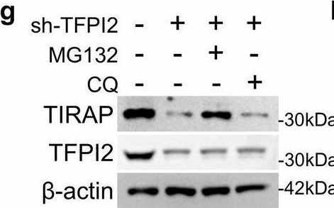 Fig.6.G showing Western Blotting in a Rattus norvegicus (Rat) sample from the publication: Hypothermic oxygenated perfusion inhibits CLIP1-mediated TIRAP ubiquitination via TFPI2 to reduce ischemia‒reperfusion injury of the fatty liver.