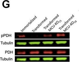 Fig.5.G showing Western Blotting in a Mus musculus (House mouse) sample from the publication: The mitochondrial Ca2+ channel MCU is critical for tumor growth by supporting cell cycle progression and proliferation.